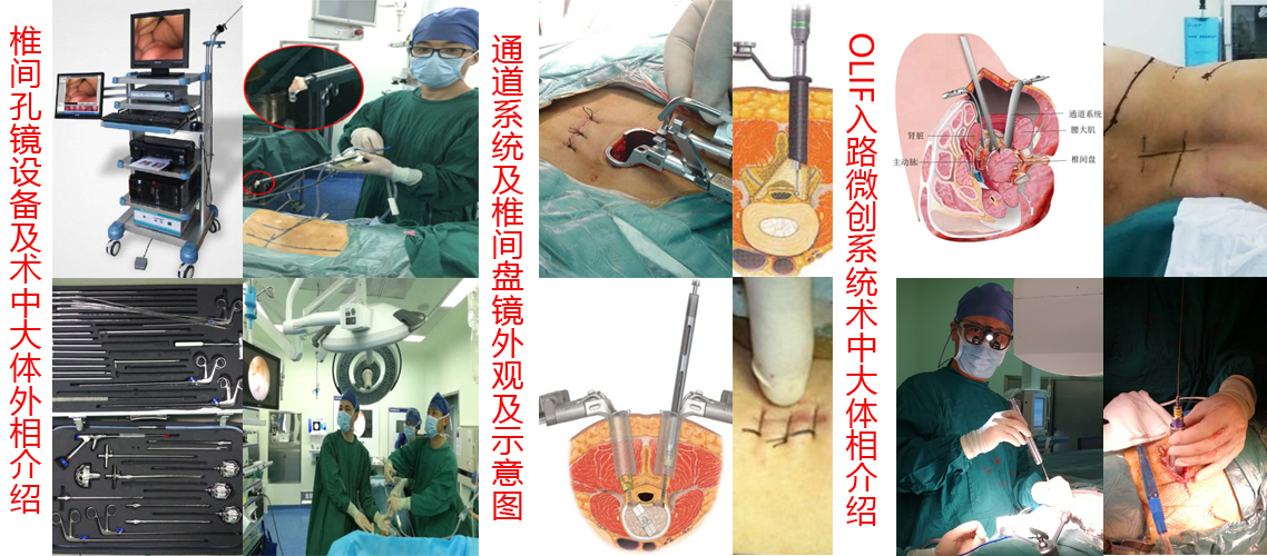 脊柱微创设备展示.jpg